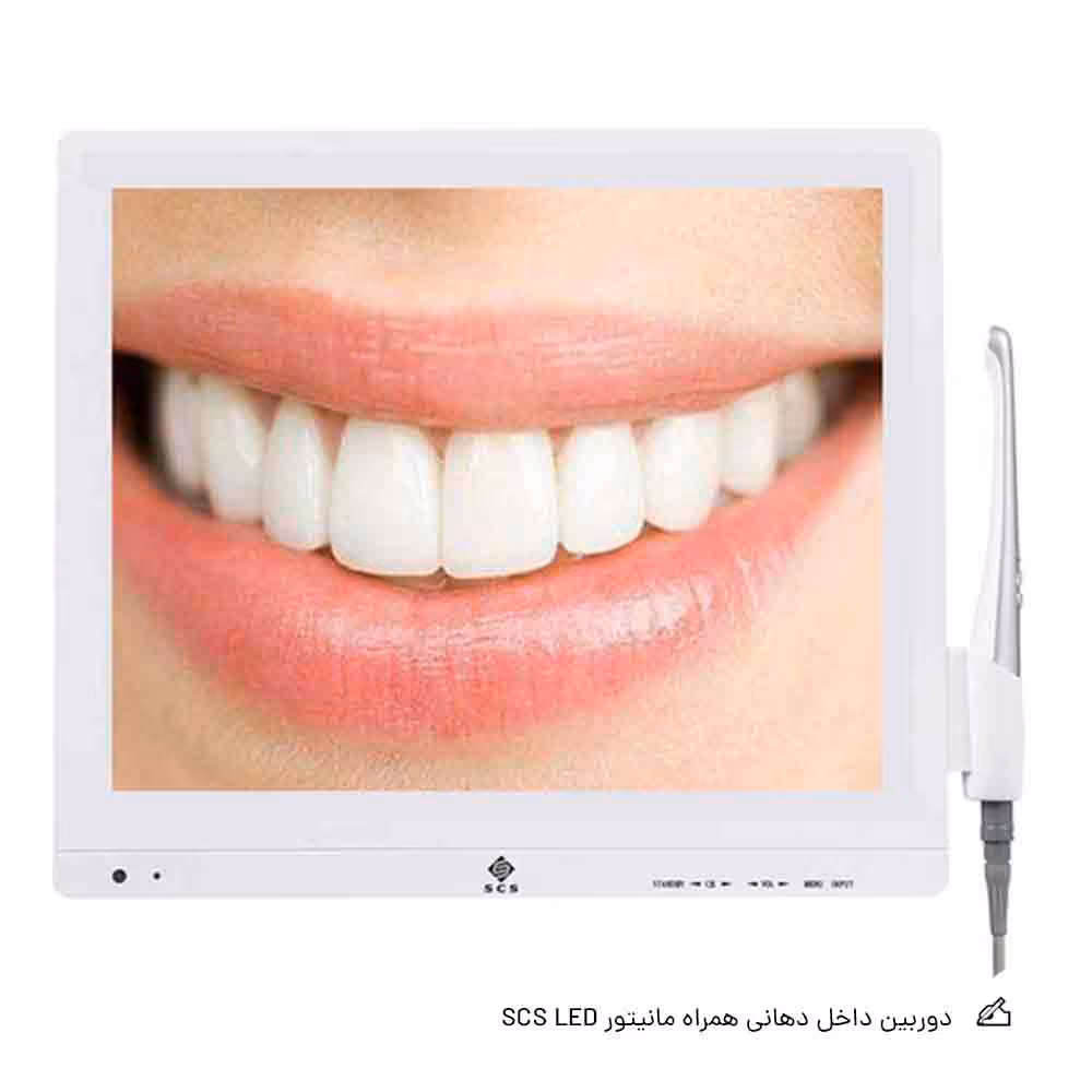 دوربین داخل دهانی همراه مانیتور SCS LED