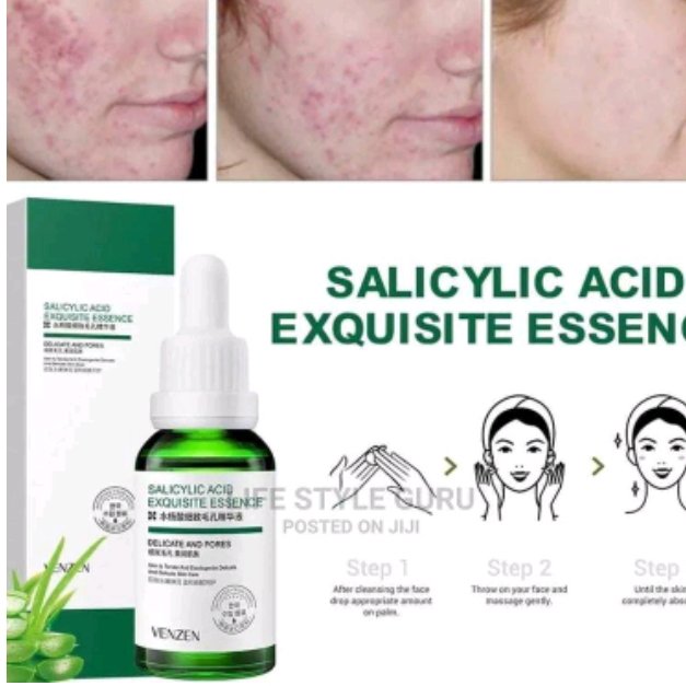 سرم سالیسیلیک اسید ونزن30میلvenzen 