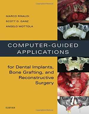[PDF] دانلود کتاب Computer-Guided Applications For Dental Implants, Bone Grafting, And Reconstructive Surgery, 2015