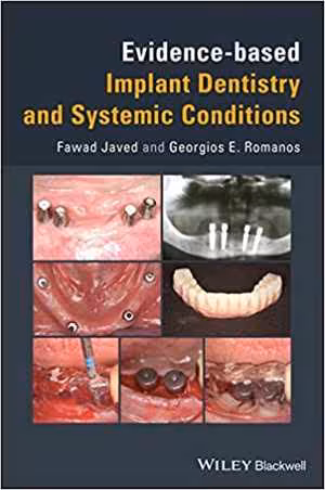 [PDF] دانلود کتاب Evidence-Based Implant Dentistry And Systemic Conditions, 2018