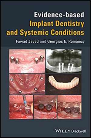 [PDF] دانلود کتاب Evidence-Based Implant Dentistry And Systemic Conditions, 2018