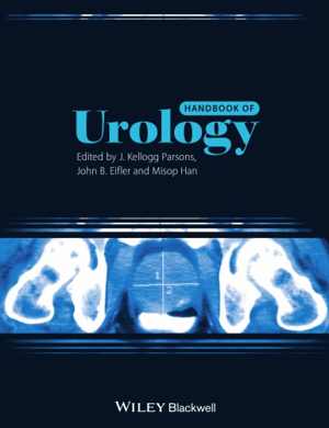 [PDF] دانلود کتاب Handbook Of Urology, 2013