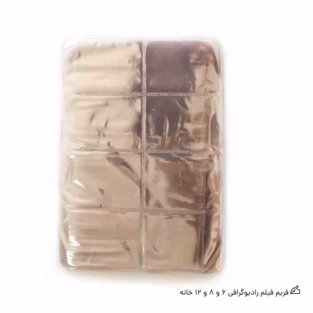 فریم فیلم رادیوگرافی زلال