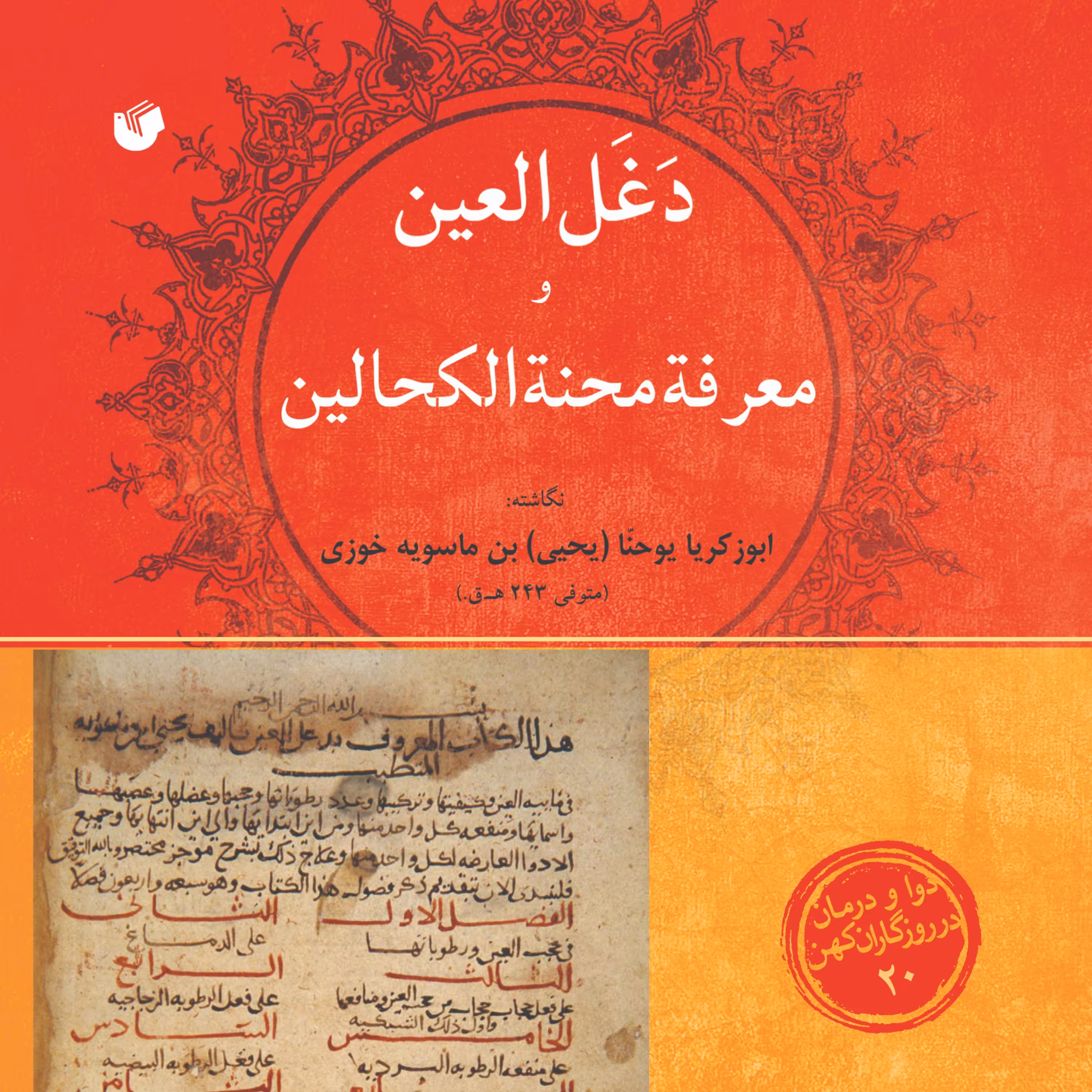 دغل العین و معرفه محنه الکحالین