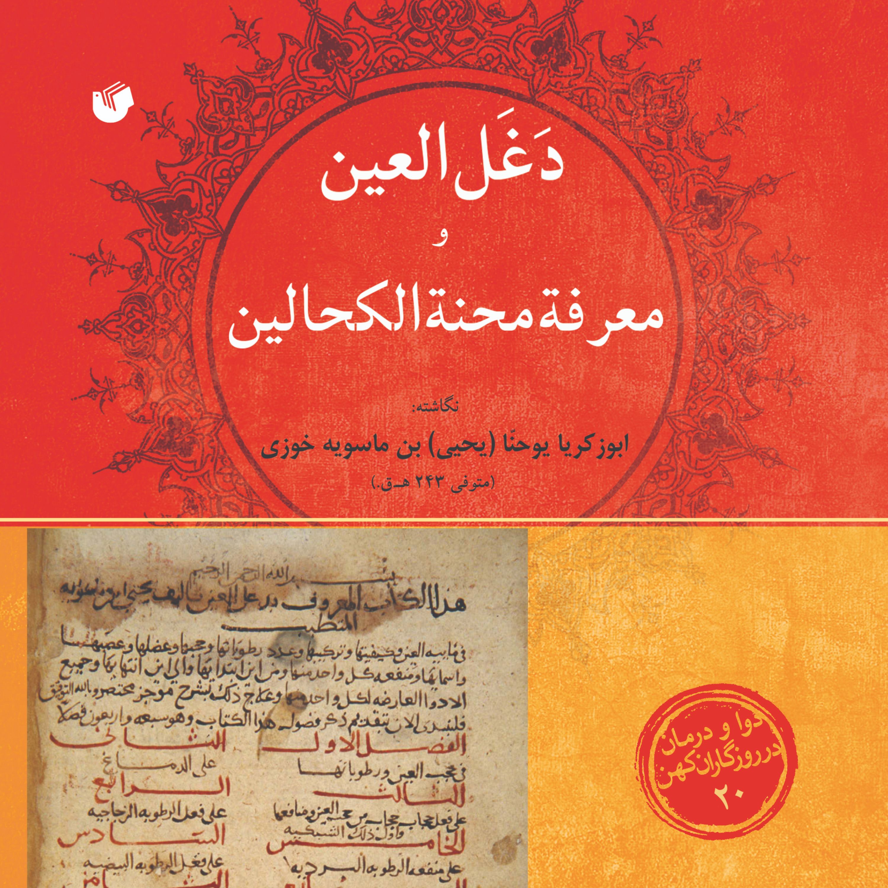دغل العین و معرفه محنه الکحالین