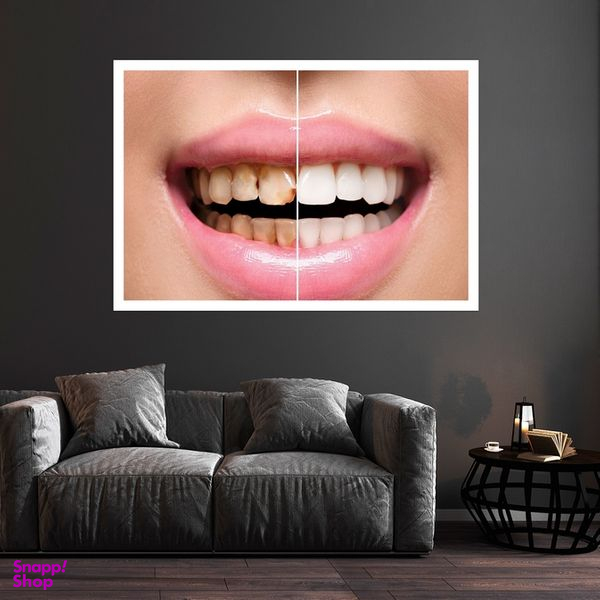 تابلو بکلیت طرح لبخند و دندانپزشکی مدل قاب شاسی W-s10153
