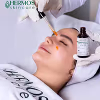 سرم لایه بردار  اسیدی هرموس  50 میل