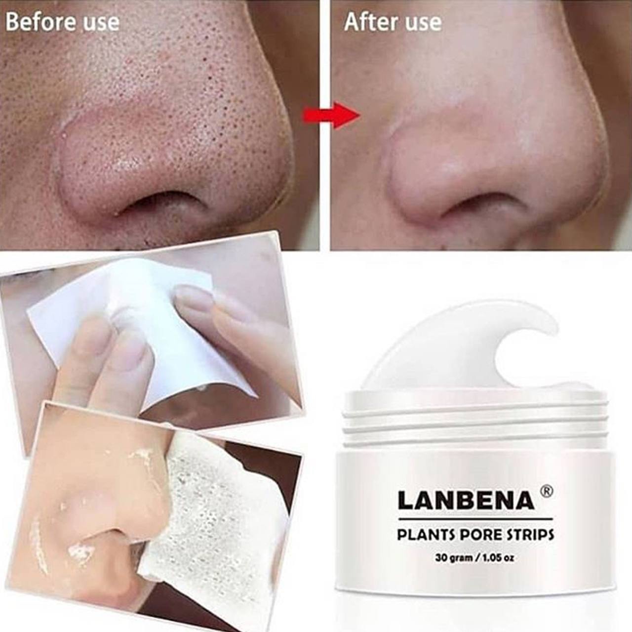 چسب بینی لانبنا ( ضد جوش سر سیاه)