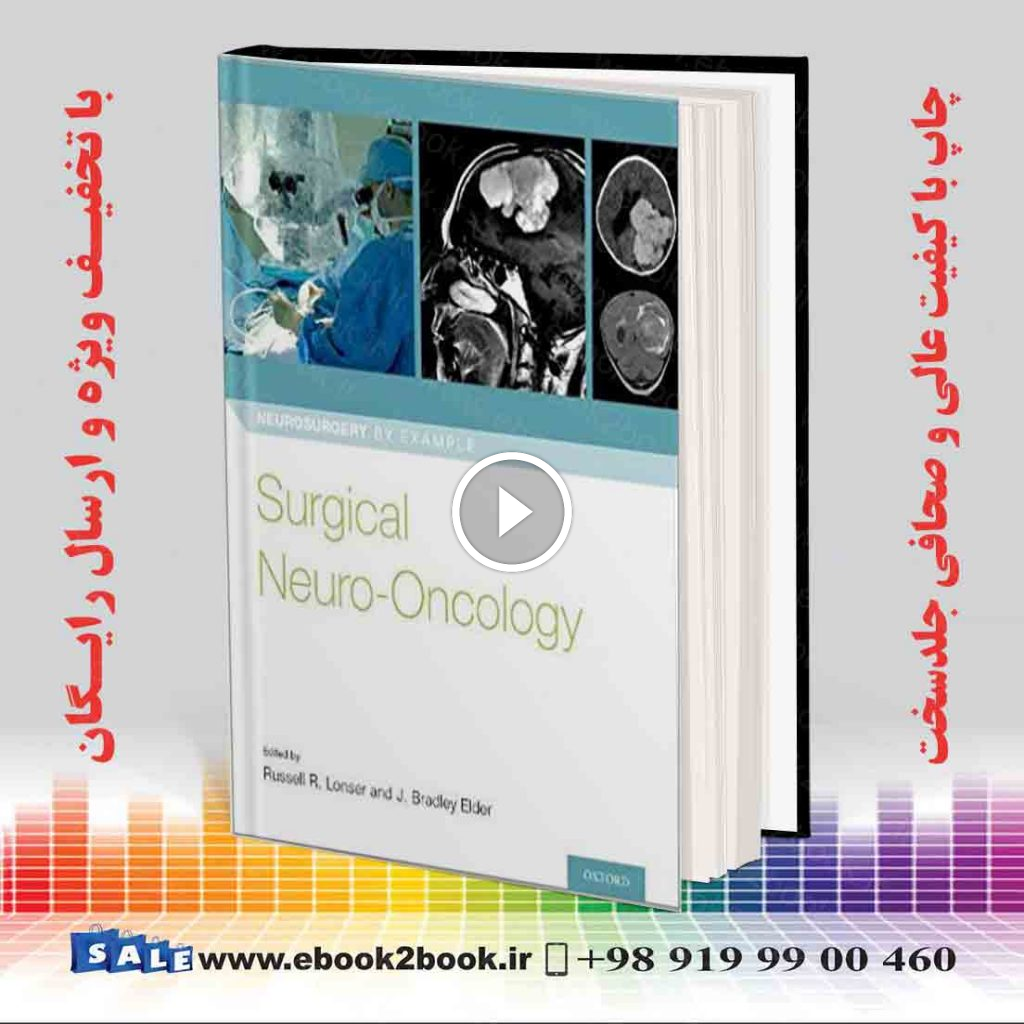 Surgical Neuro-Oncology (Neurosurgery by Example)