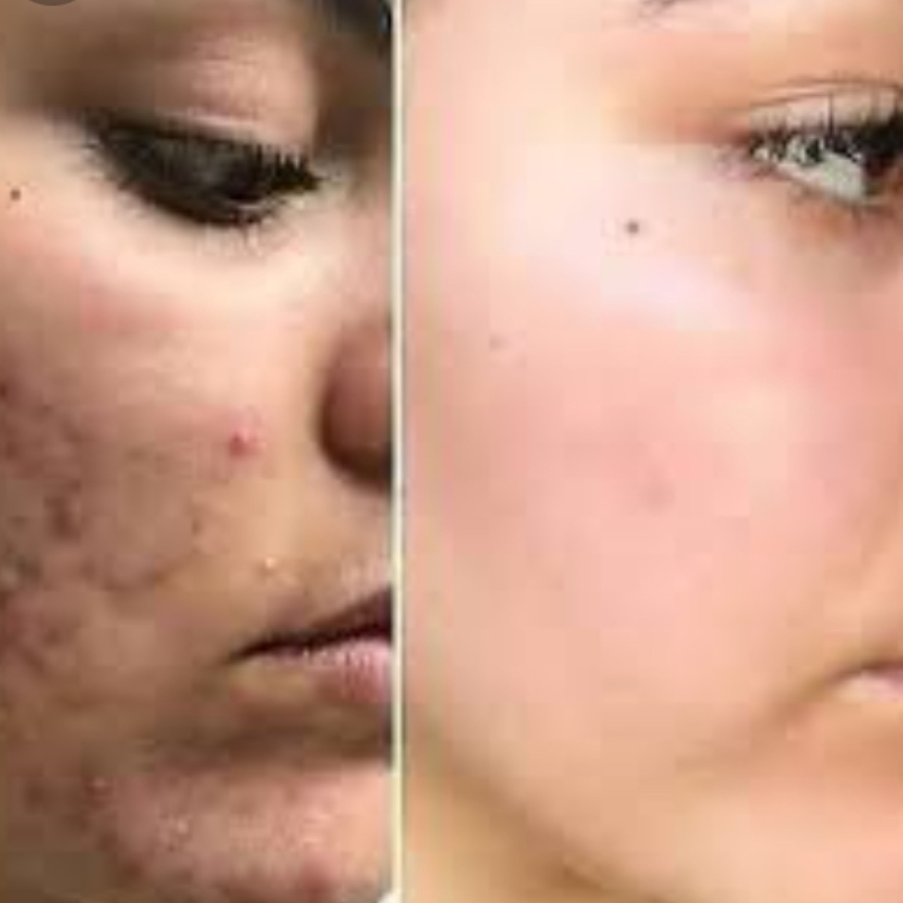 کرم  شب گیاهی  وبهبود دهنده گیاهی