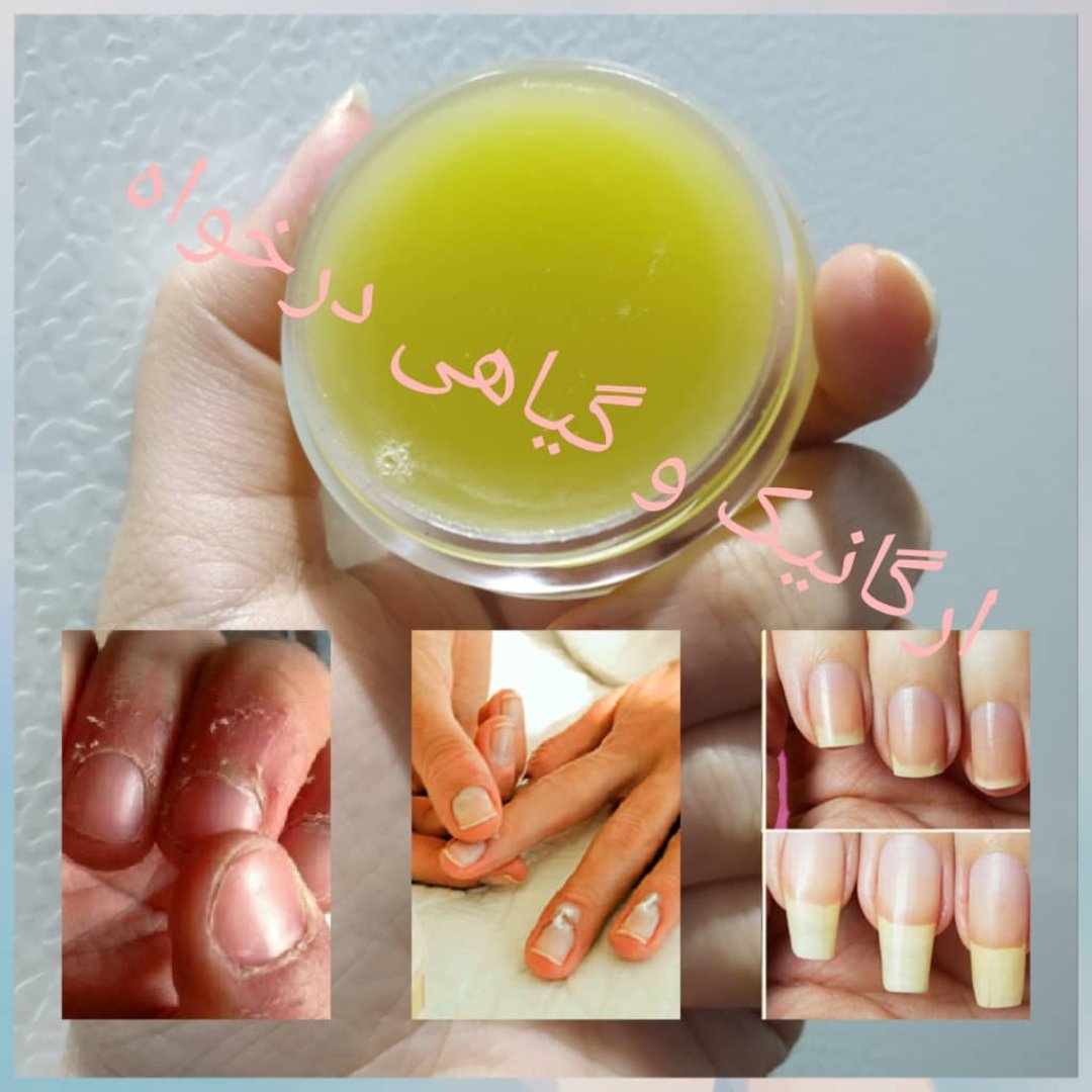 پماد ناخن درخواه