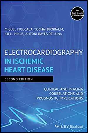 [PDF] دانلود کتاب Electrocardiography In Ischemic Heart Disease ; Clinical And Imaging Correlations And Prognostic Implications, 2nd ed, 2020