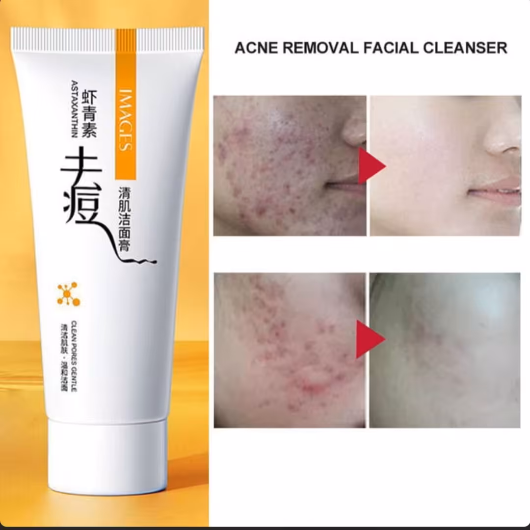 فوم ضد جوش و منافذ ایمیجز