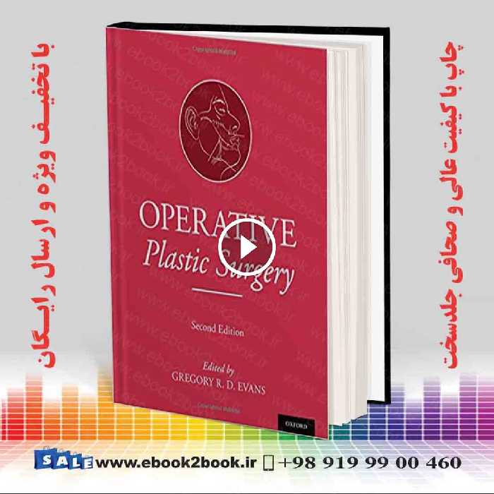Operative Plastic Surgery 2nd Edition