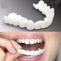 لمینت متحرک دندان اسنپ آن اسمایل یا کاور دندان ، هردوفک، SnapOnSmile - بنابه درخواست مشتریان عزیز  شارژ مجدد شد.
