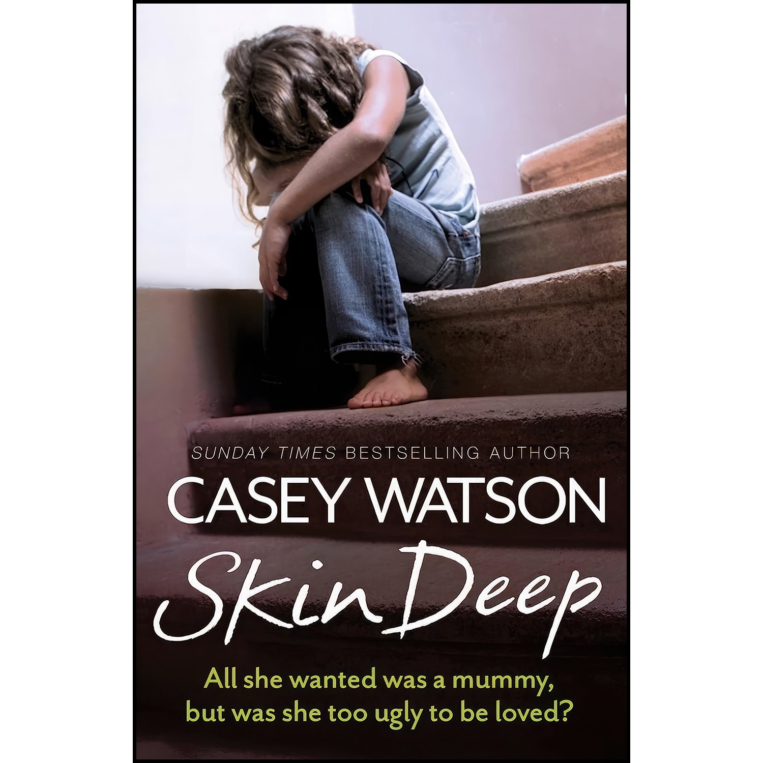کتاب زبان اصلی Skin Deep اثر Casey Watson