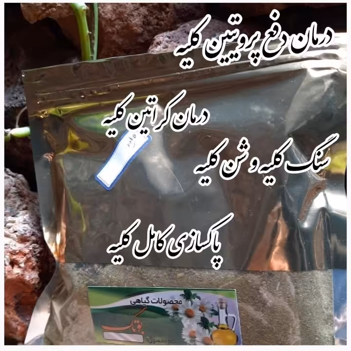 دفع سنگ کلیه 