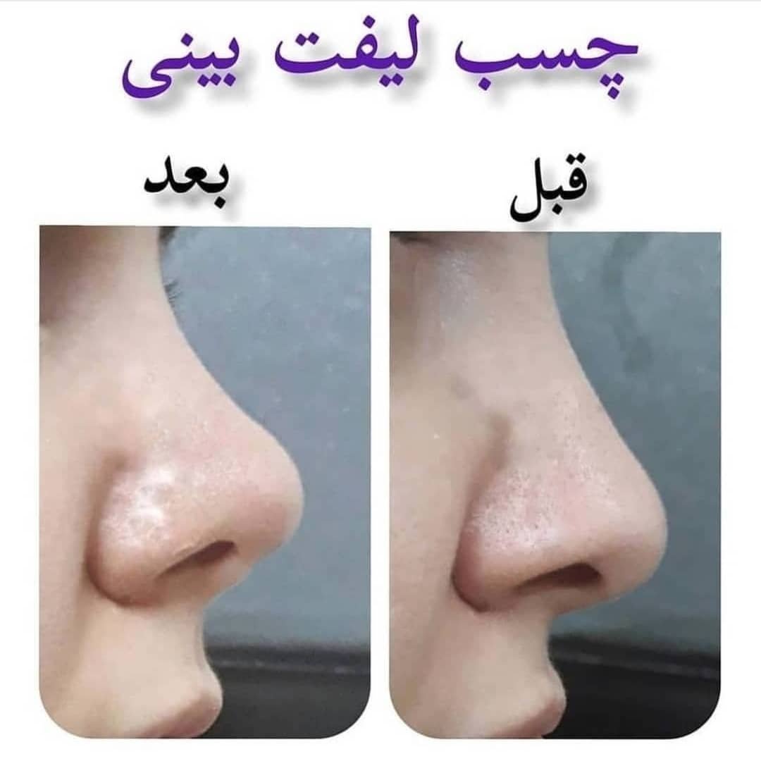 چسب لیفت بینی اصل