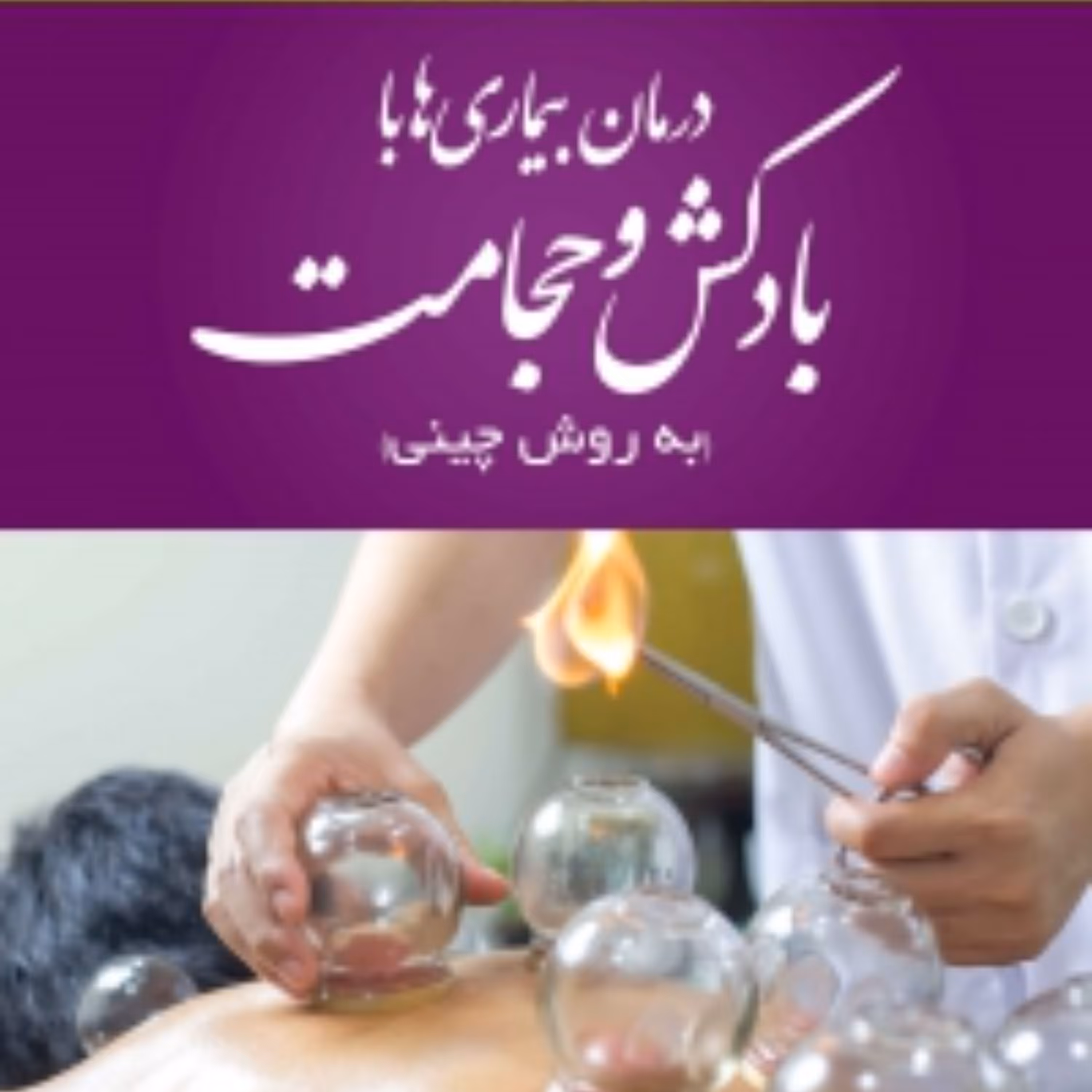 درمان بیماری ها با بادکش و حجامت (به روش چینی)