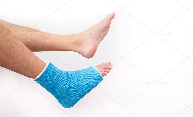 عکس پا گچ شده | گرافیک با طعم تربچه