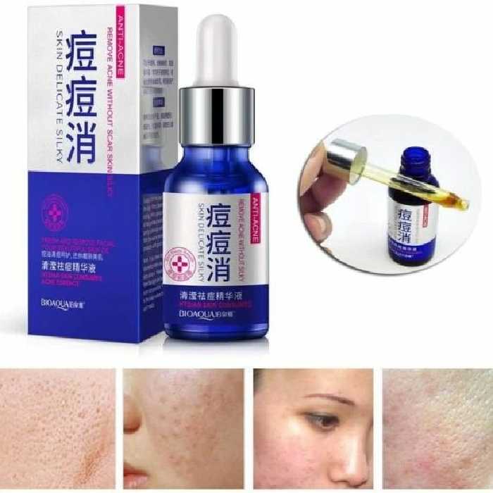 سرم ضد جوش ابریشمی بیواکوا