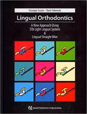 [PDF] دانلود کتاب Lingual Orthodontics - A New Approach Using Stb Light Lingual System And Lingual Straight Wire, 2010