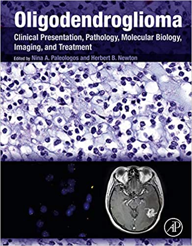  دانلود کتاب Oligodendroglioma - Clinical Presentation, Pathology, Molecular Biology, Imaging, And Treatment, 2019 - دانلود کتاب های دانشگاهی