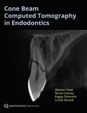 [PDF] دانلود کتاب Cone Beam Computed Tomography In Endodontics, 2016