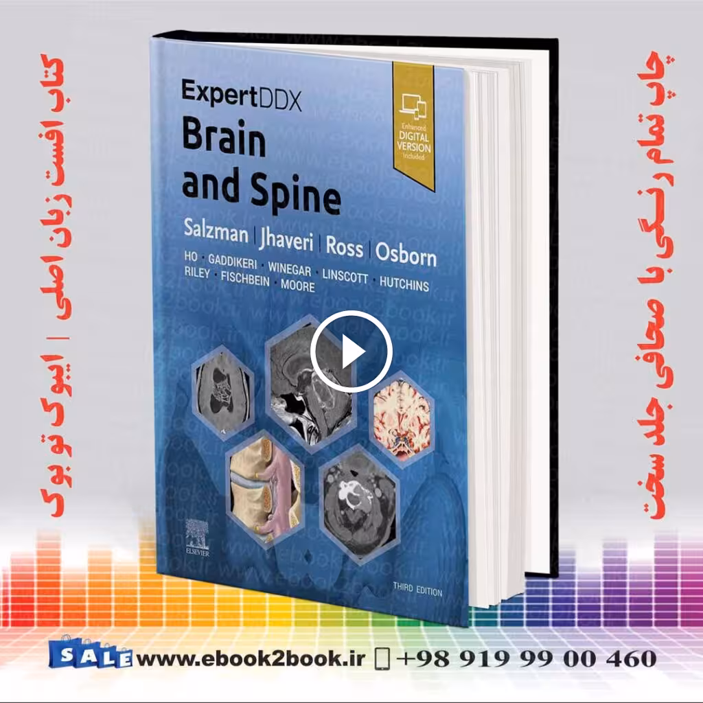 ExpertDDx Brain and Spine 3rd Edition