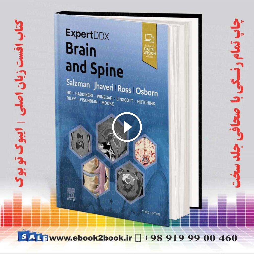 ExpertDDx Brain and Spine 3rd Edition