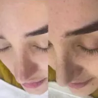 کوکتل ضدلک و روشن کننده ژنوسیس اصل