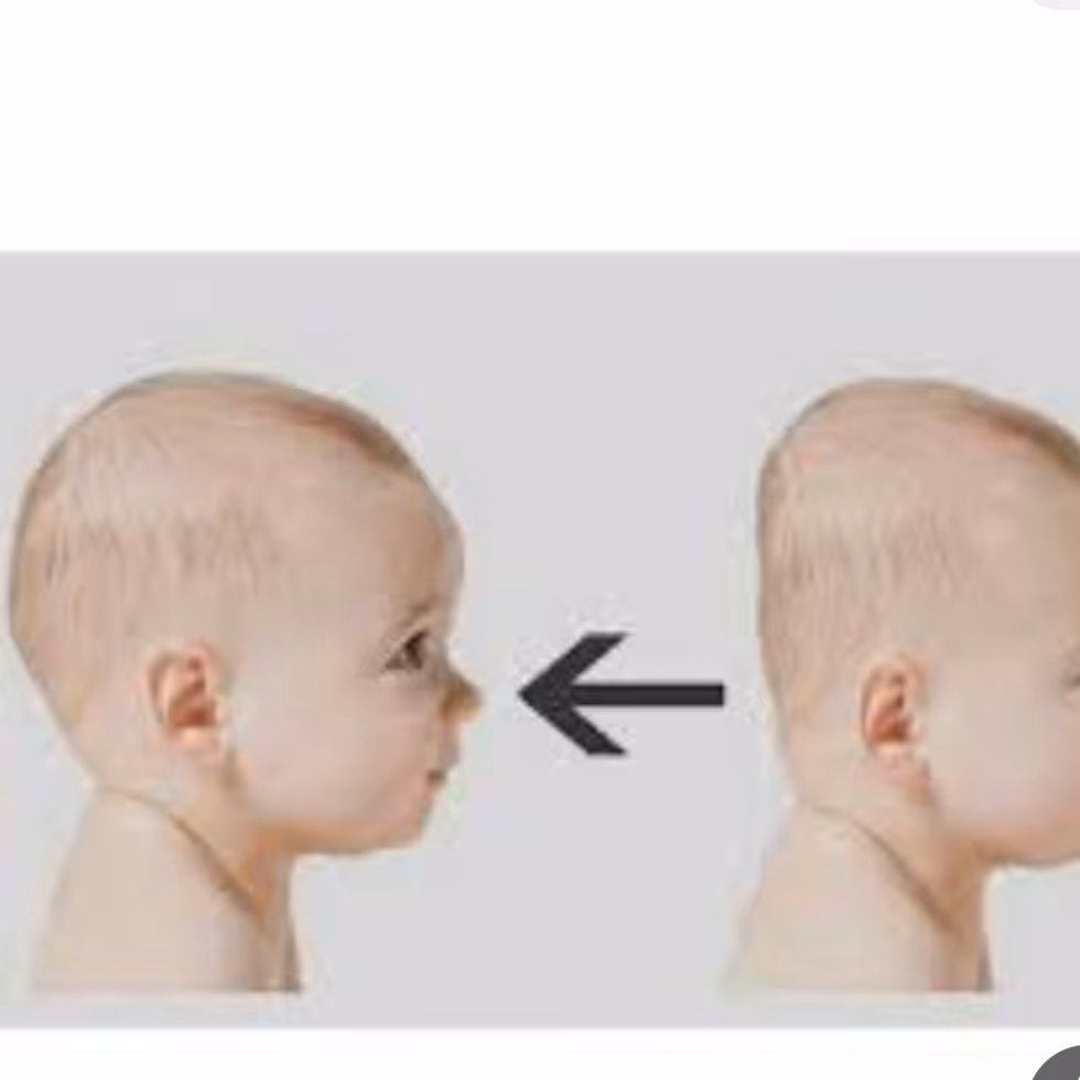 بالشت  فرم دهی سر نوزاد