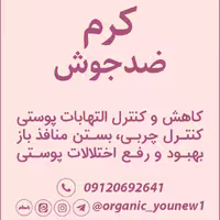 کرم ضدجوش طبیعی ظرف تیوپی Younew (دستساز و فاقد ترکیبات شیمیایی)