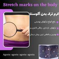 کرم رفع ترک پوستی بدن
