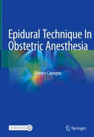 [PDF] دانلود کتاب Epidural Technique In Obstetric Anesthesia, 2020