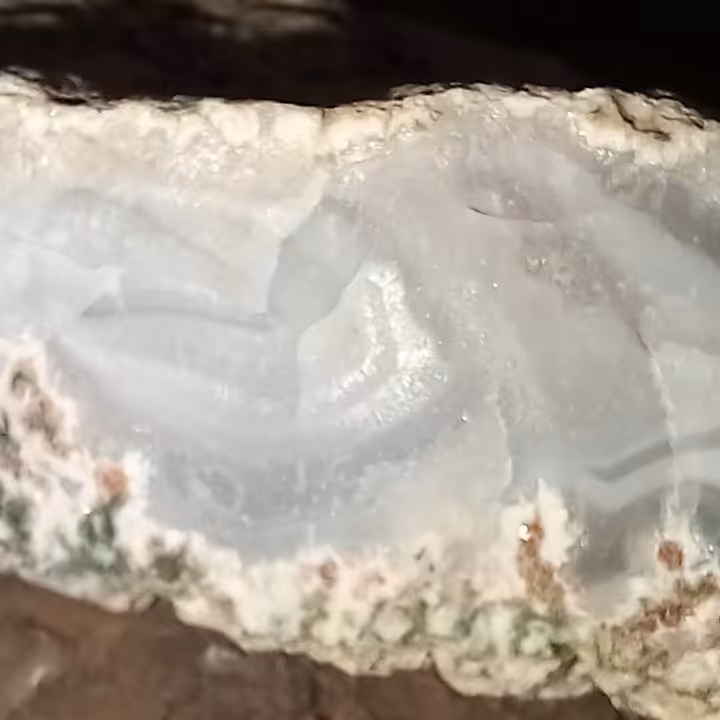 سلیمانی لیزری