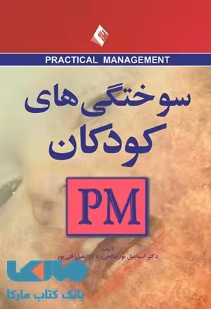 سوختگی های کودکان (PM) نشر ارجمند