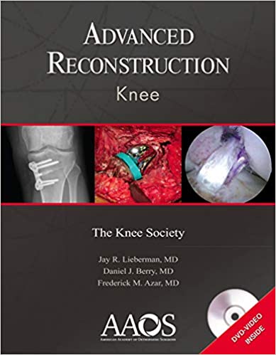 󾕇 دانلود کتاب Advanced Reconstruction - Knee, 2010 - دانلود کتاب های دانشگاهی