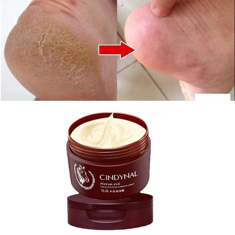کرم روغن اسب سیندینال از بین برنده ترکهای پوستی دست و پاشنه پا نرم کننده پوست و ترمیم بافت خشک پوست
