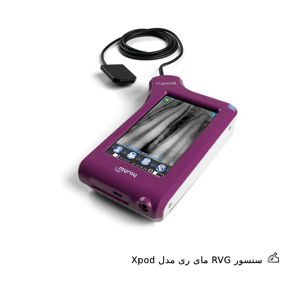 سنسور RVG مای ری مدل Xpod