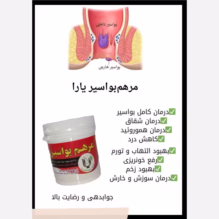 رفع بواسیر