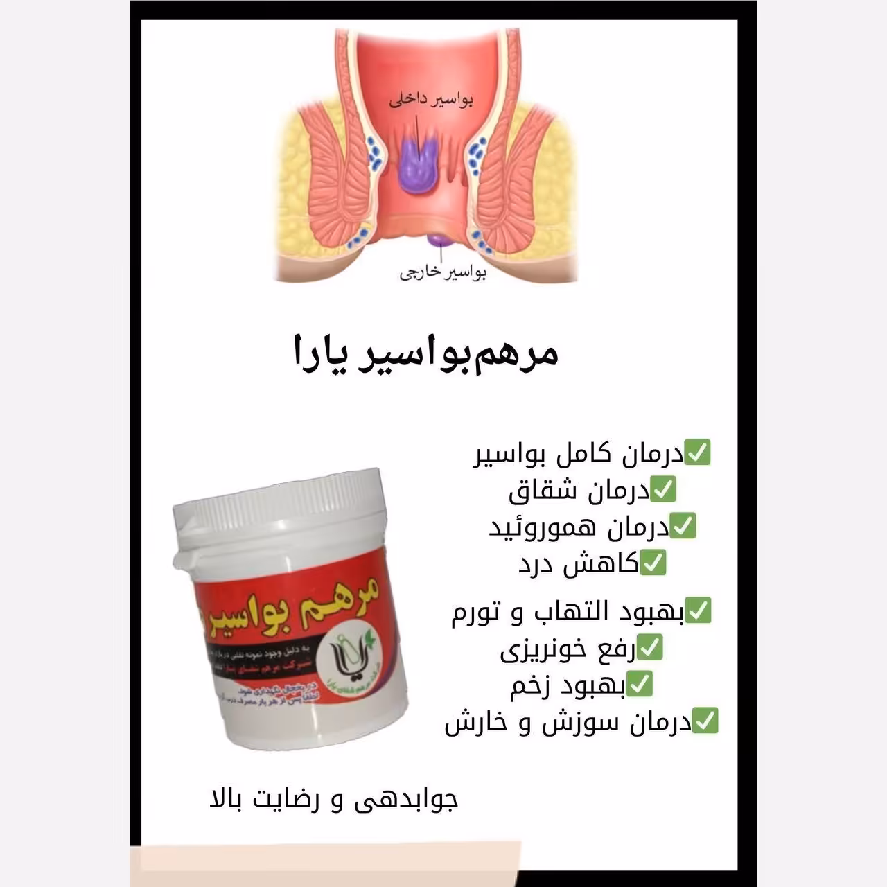 رفع بواسیر
