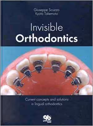 [PDF] دانلود کتاب Invisible Orthodontics - Current Concepts And Solutions In Lingual Orthodontics, 2002