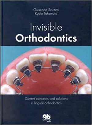 [PDF] دانلود کتاب Invisible Orthodontics - Current Concepts And Solutions In Lingual Orthodontics, 2002