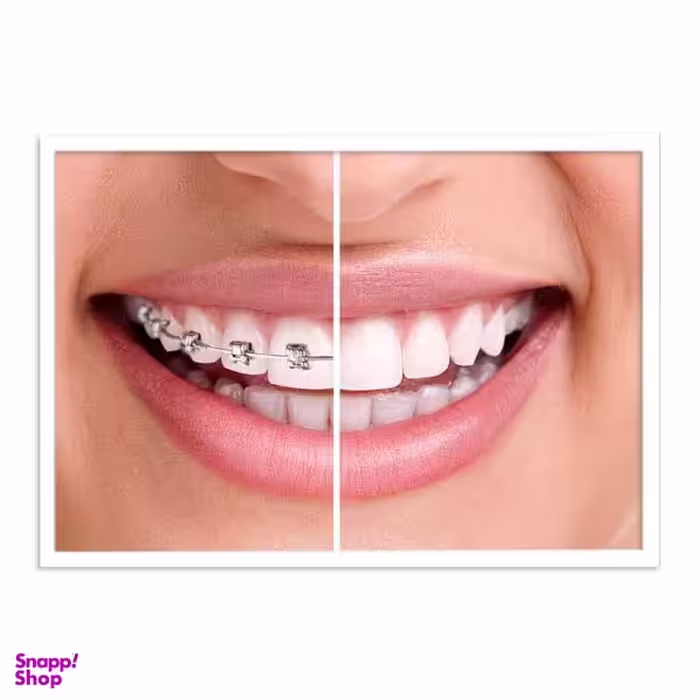تابلو بکلیت طرح دندانپزشکی مدل W-s676