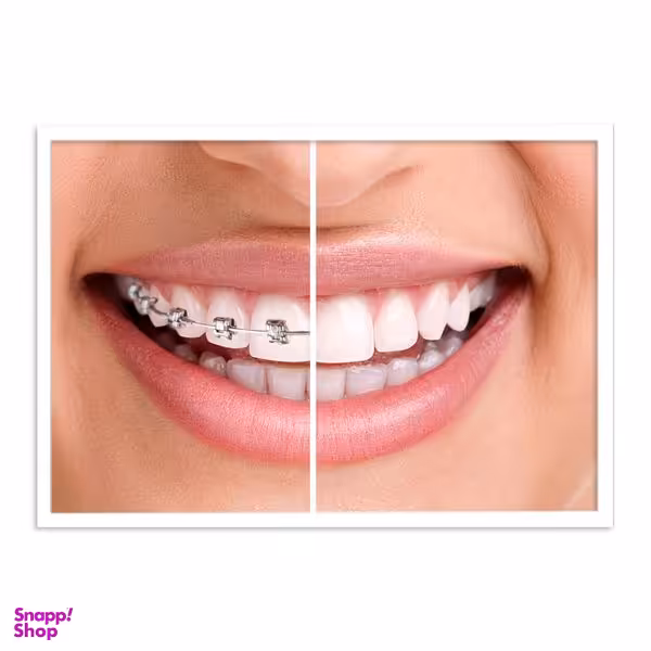 تابلو بکلیت طرح دندانپزشکی مدل W-s676