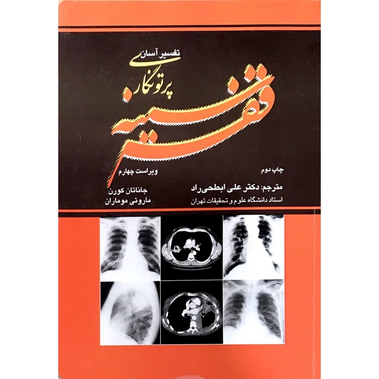 تفسیر آسان پرتونگاری قفسه سینه (ویراست چهارم)