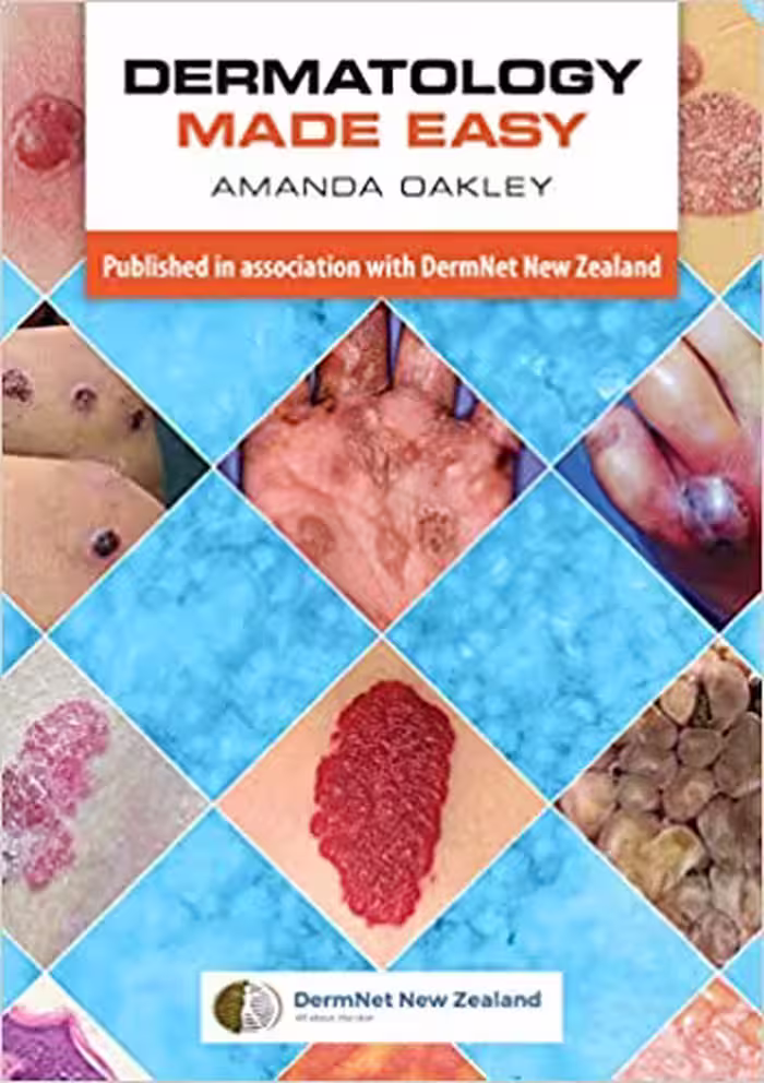 󾕇 دانلود کتاب Dermatology Made Easy, 2017 - دانلود کتاب های دانشگاهی