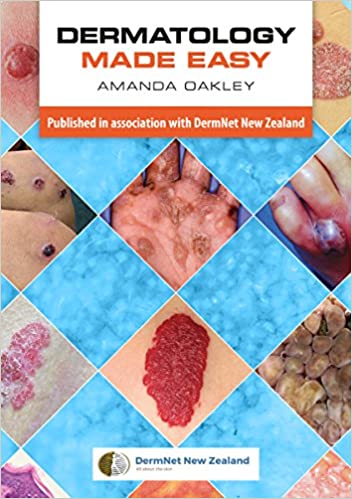  دانلود کتاب Dermatology Made Easy, 2017 - دانلود کتاب های دانشگاهی