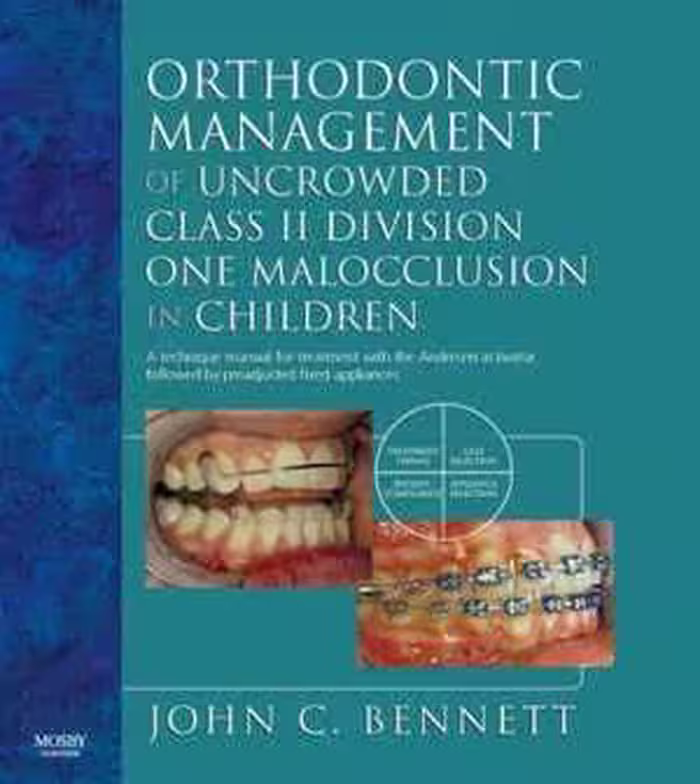 [PDF] دانلود کتاب Orthodontic Management Of Uncrowded Class II Division One Malocclusion In Children, 2006